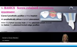 Screw Retention Feature Prosthetic Management of Posterior Regions - Congress Lectures - ITI